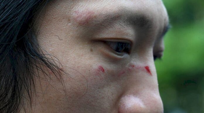 中共二十大/被英國警察救起!遭暴打港人還原現場