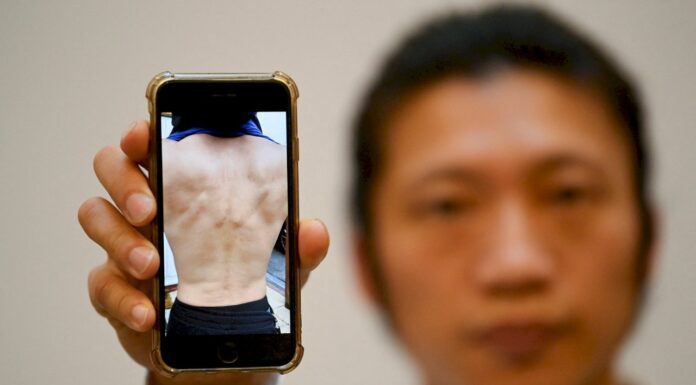 在英遭暴打港人:台灣人絕對可能是下一個